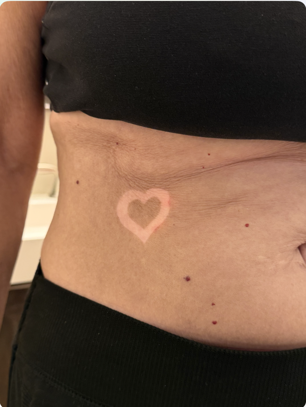 Natural, even spray tan on the stomach with a white heart stencil outline